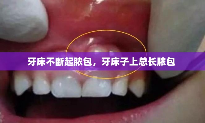牙床不断起脓包,牙床子上总长脓包
